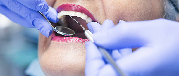 Best Weekend Emergency Dental Services in Hanover, IN